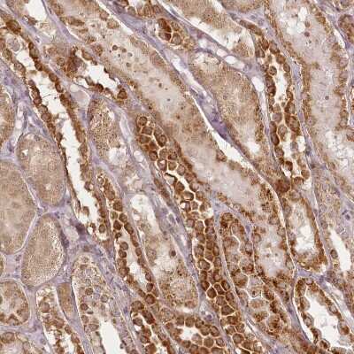 Immunohistochemistry-Paraffin: CHCHD2 Antibody [NBP1-94106]