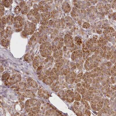 Immunohistochemistry-Paraffin: CHCHD2 Antibody [NBP1-94106]