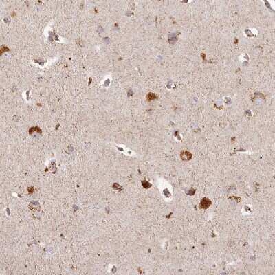 Immunohistochemistry-Paraffin: CHCHD2 Antibody [NBP1-94106]