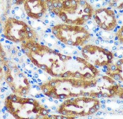 Immunohistochemistry-Paraffin: CHCHD2 Antibody - Azide and BSA Free [NBP2-92335]