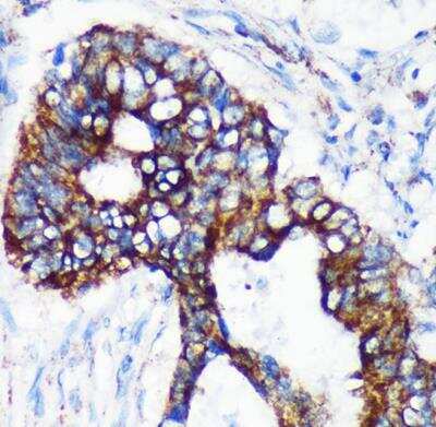Immunohistochemistry-Paraffin: CHCHD2 Antibody - Azide and BSA Free [NBP2-92335]