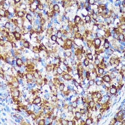 Immunohistochemistry-Paraffin: CHCHD2 Antibody - Azide and BSA Free [NBP2-92335]