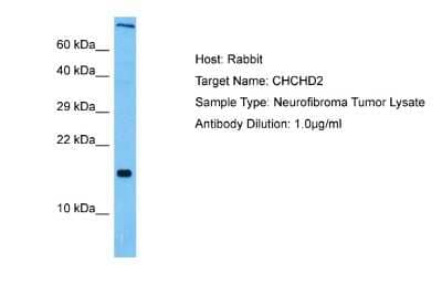 Western Blot: CHCHD2 Antibody [NBP2-84670]