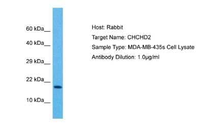 Western Blot: CHCHD2 Antibody [NBP2-84671]