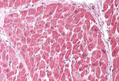 Immunohistochemistry-Paraffin: CHCHD3 Antibody [NBP1-52008]