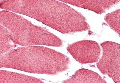 Immunohistochemistry-Paraffin: CHCHD3 Antibody [NBP1-52008]