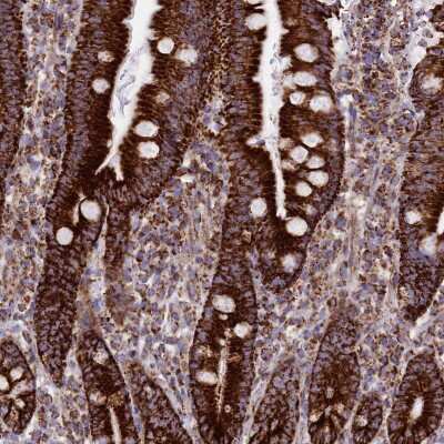 Immunohistochemistry-Paraffin: CHCHD3 Antibody [NBP1-83656]