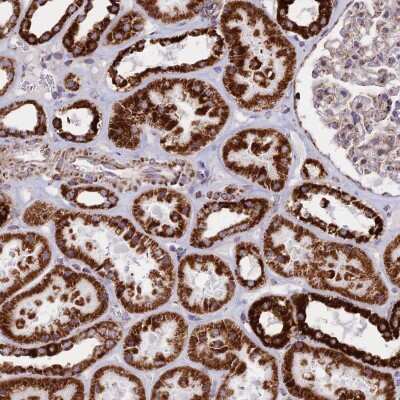 Immunohistochemistry-Paraffin: CHCHD3 Antibody [NBP1-83656]
