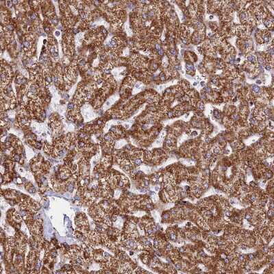 Immunohistochemistry-Paraffin: CHCHD3 Antibody [NBP1-83656]