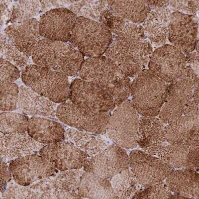 Immunohistochemistry-Paraffin: CHCHD3 Antibody [NBP1-83656]