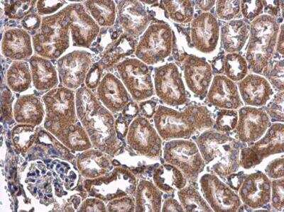 Immunohistochemistry-Paraffin: CHCHD3 Antibody [NBP2-21606]