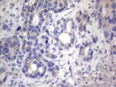 Immunohistochemistry: CHCHD3 Antibody (OTI7G4) - Azide and BSA Free [NBP2-71975]