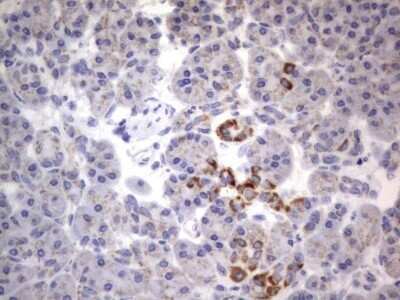 Immunohistochemistry: CHCHD3 Antibody (OTI7G4) - Azide and BSA Free [NBP2-71975]