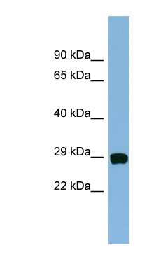 Western Blot: CHCHD3 Antibody [NBP1-56870]