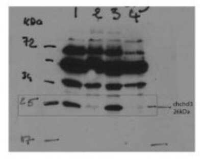 Western Blot: CHCHD3 Antibody [NBP1-56871]