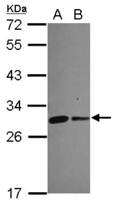 Western Blot: CHCHD3 Antibody [NBP2-21606]