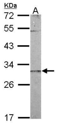 Western Blot: CHCHD3 Antibody [NBP2-21606]