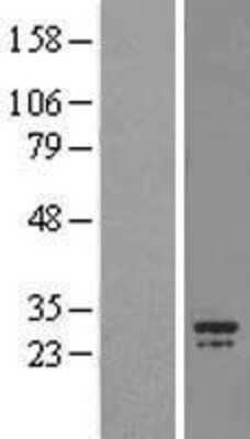 Western Blot: CHCHD3 Overexpression Lysate [NBL1-09142]