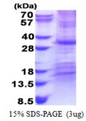 SDS-PAGE: Recombinant Human CHCHD3 His Protein [NBP2-22791]