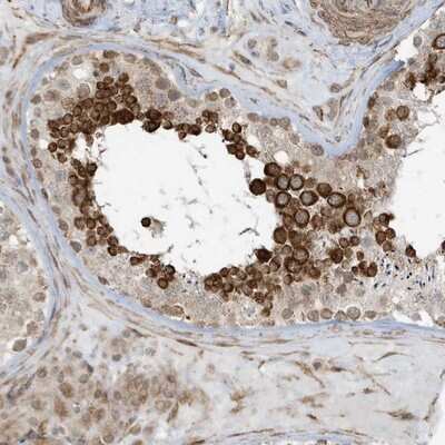 Immunohistochemistry-Paraffin: CHCHD4 Antibody [NBP1-83537]