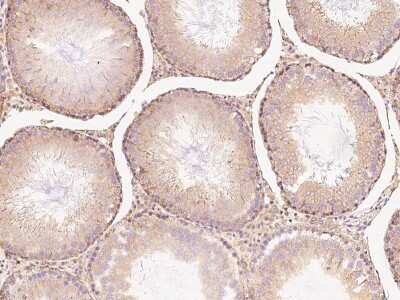 Immunohistochemistry-Paraffin: CHCHD4 Antibody [NBP2-99532]