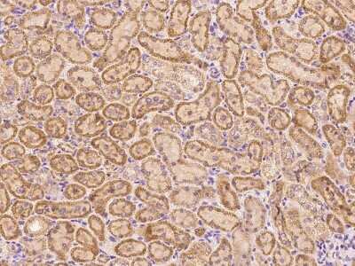 Immunohistochemistry-Paraffin: CHCHD4 Antibody [NBP2-99532]