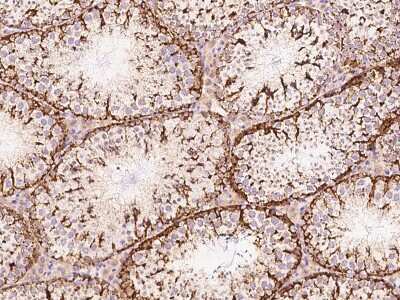 Immunohistochemistry-Paraffin: CHCHD4 Antibody [NBP2-99532]