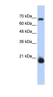 Western Blot: CHCHD4 Antibody [NBP1-54783]