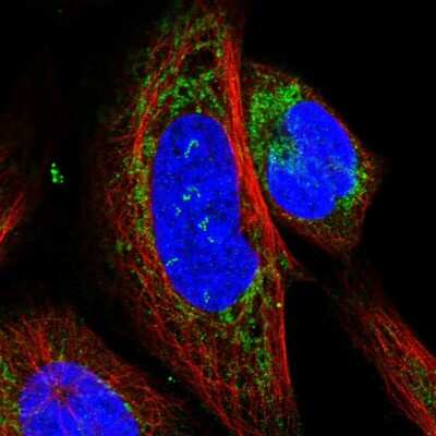Immunocytochemistry/ Immunofluorescence: CHCHD5 Antibody [NBP1-86796]