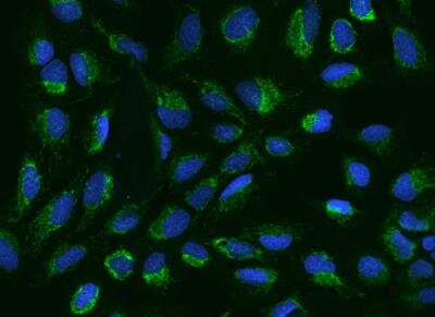 Immunocytochemistry/ Immunofluorescence: CHCHD5 Antibody [NBP3-05899]