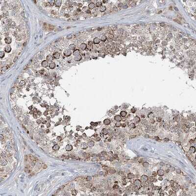 Immunohistochemistry-Paraffin: CHCHD5 Antibody [NBP1-86796]