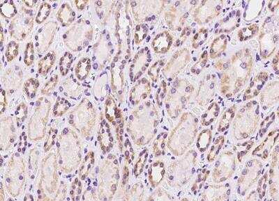 Immunohistochemistry-Paraffin: CHCHD5 Antibody [NBP3-05899]