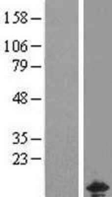 Western Blot: CHCHD5 Overexpression Lysate [NBL1-09143]