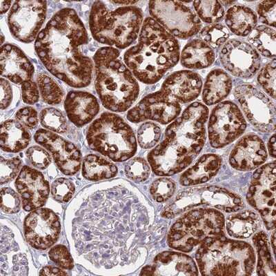 Immunohistochemistry-Paraffin: CHCHD6 Antibody [NBP1-91779]