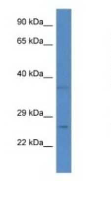 Western Blot: CHCHD6 Antibody [NBP1-79819]