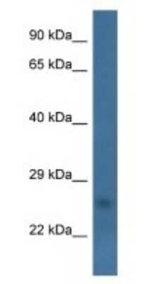 Western Blot: CHCHD6 Antibody [NBP1-79820]