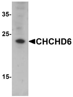 Western Blot: CHCHD6 AntibodyBSA Free [NBP2-81977]