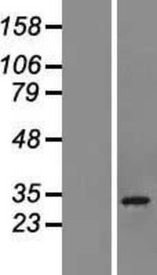 Western Blot: CHCHD6 Overexpression Lysate [NBL1-09144]