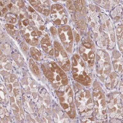 Immunohistochemistry-Paraffin: CHCHD7 Antibody [NBP2-14477]
