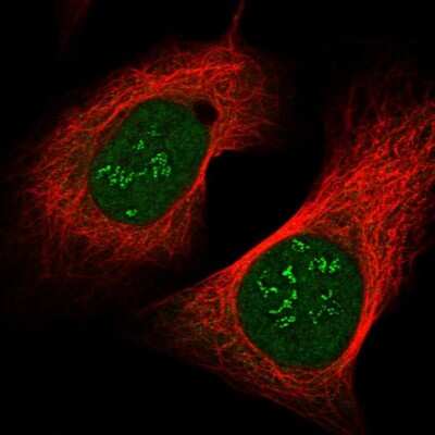 Immunocytochemistry/ Immunofluorescence: CHCHD8 Antibody [NBP1-90483]