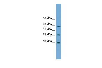 Western Blot: CHCHD8 Antibody [NBP2-82672]