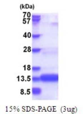 SDS-PAGE: Recombinant Human CHCHD8 His Protein [NBP2-51728]