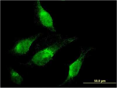 Immunocytochemistry/ Immunofluorescence: CHD1 Antibody (1G2) [H00001105-M04]