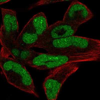 Immunocytochemistry/ Immunofluorescence: CHD1 Antibody [NBP2-14478]