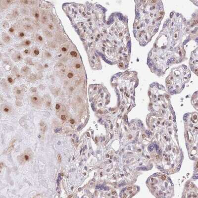Immunohistochemistry-Paraffin: CHD1 Antibody [NBP2-14478]