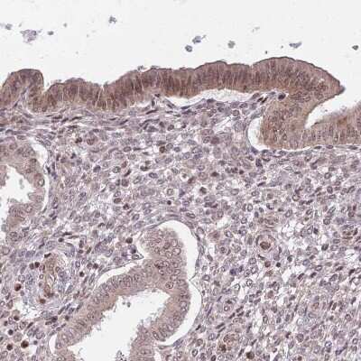 Immunohistochemistry-Paraffin: CHD1 Antibody [NBP2-14478]