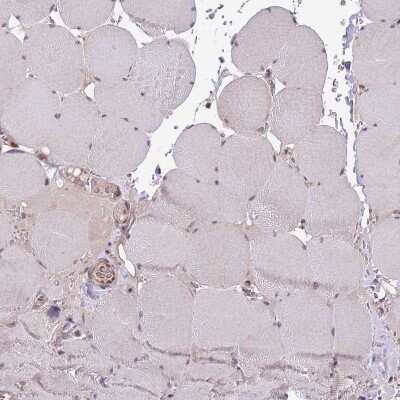 Immunohistochemistry-Paraffin: CHD1 Antibody [NBP2-14478]