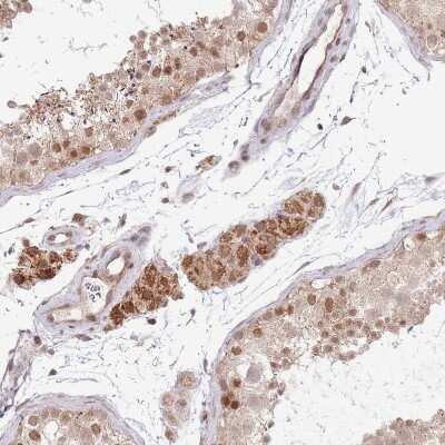 Immunohistochemistry-Paraffin: CHD1 Antibody [NBP2-14478]