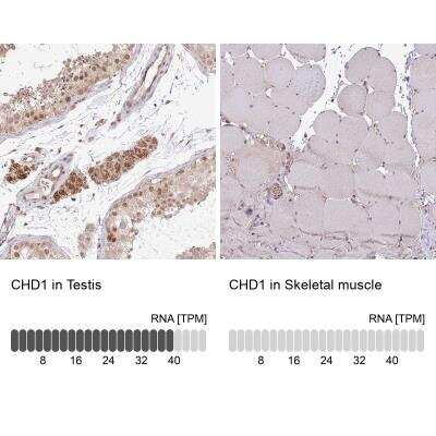 Immunohistochemistry-Paraffin: CHD1 Antibody [NBP2-14478]
