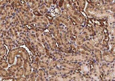 Immunohistochemistry-Paraffin: CHD1 Antibody [NBP2-98902]